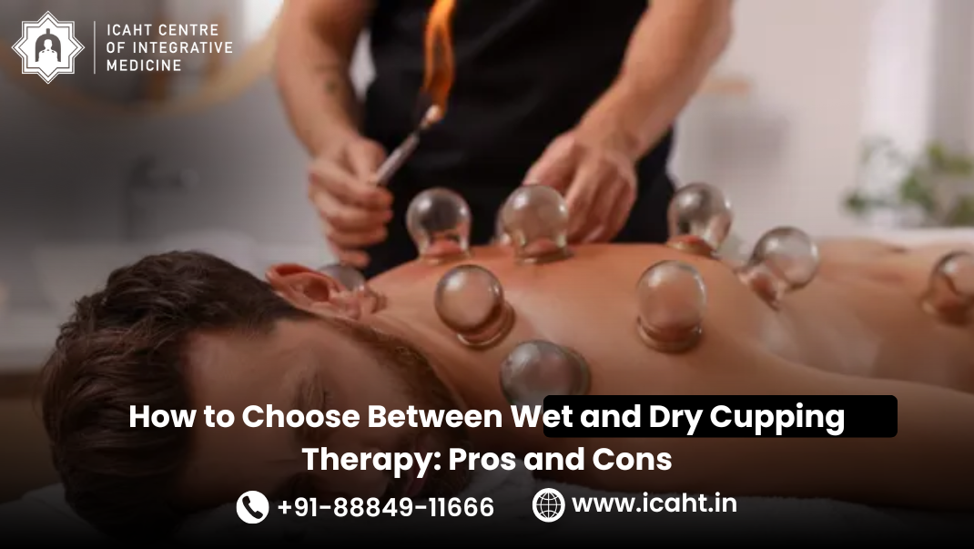 Dry Cupping Therapy